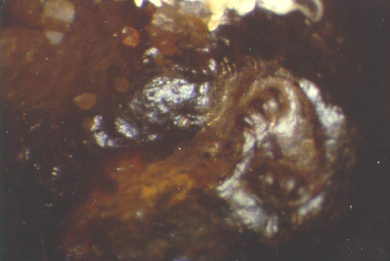 A varroa mite that has been trapped between the cocoon and the cell wall (as seen from above after removing the bee larva).  